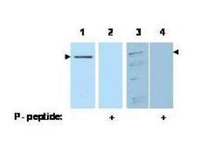 Western Blot: PDCD4 [p Ser457] Antibody [NB110-60014]